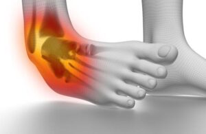 Ankle Sprain treatment at PT2Go Physical Therapy in Virginia Beach, VA and Moyock NC